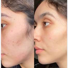 herbal-pure-product-9